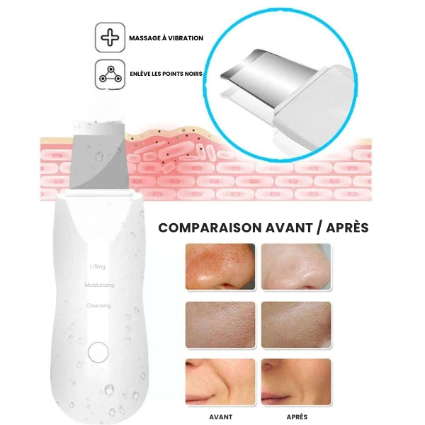 Épurateur Ultrasonique ClearPore - Nettoyage pour une Peau Parfaite