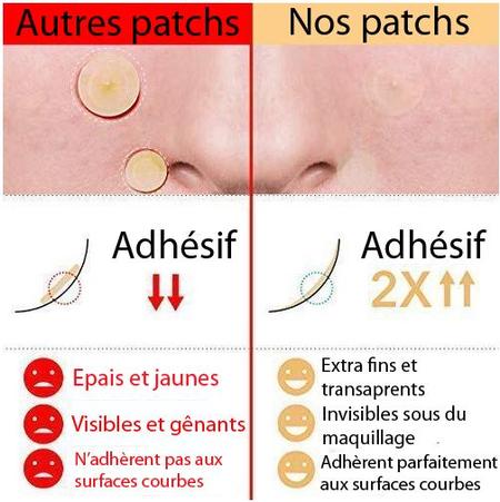 Patchs contre Boutons et Acné BREYLEE™